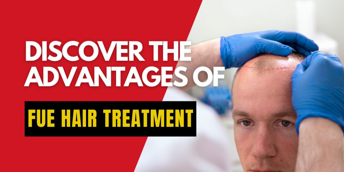 Discover the Advantages of FUE Hair Treatment