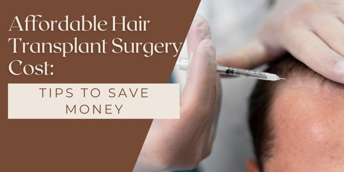 Affordable Hair Transplant Surgery Cost: Tips to Save Money